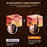 Beard Growth Oil Natural Plant Extraction Nourishing Fluid Aceites Para La Barba Facial Hair Care Growth Essential Oil