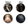 Help Growth Hair Protection Natural Anti-Hair Loss Shampoo