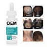 6 Months Kirland Liquid Extra Strength Hair Loss Regrowth Serum Treatment Men