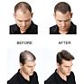 Private Label Hair Care Loss Thinning Treatment Fast Growing Ginger Essence Hair Growth Serum Spray for Women Men 30Ml