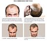 Private Label Hair Care Loss Thinning Treatment Fast Growing Ginger Essence Hair Growth Serum Spray for Women Men 30Ml